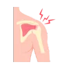 Shoulder Treatments